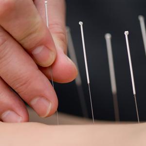 FREE box of Acupuncture Needle Samples